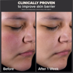 Paula's Choice Skin Perfecting - Image 5