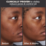 Paula's Choice Skin Perfecting - Image 9